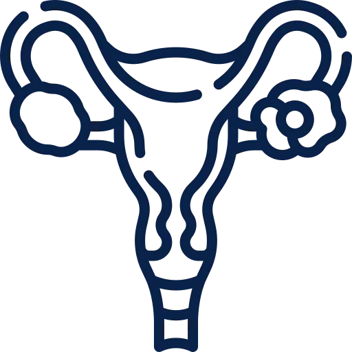 Ovarian_Cancer