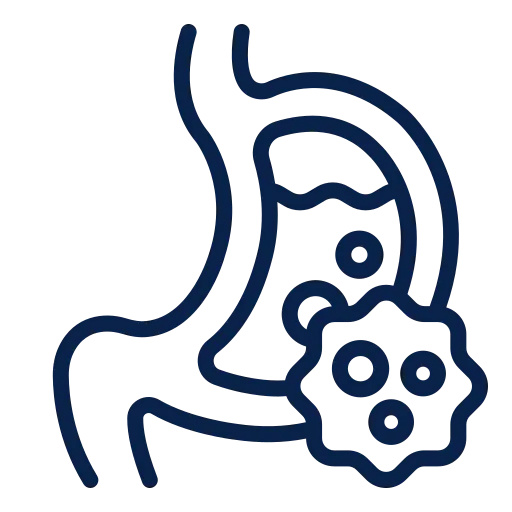 Stomach Cancer