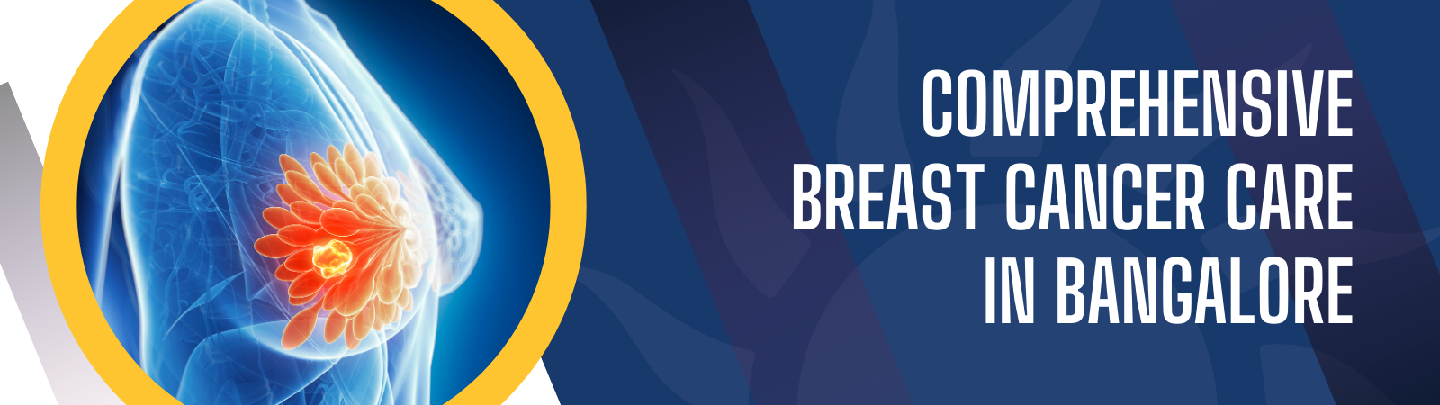 Breast Cancer Treatment Banner