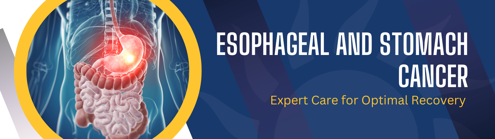 Esophageal And Stomach Cancer Banner