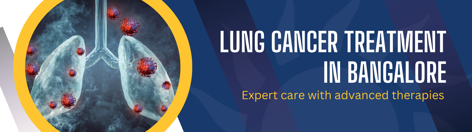 Lung Cancer Treatment Banner
